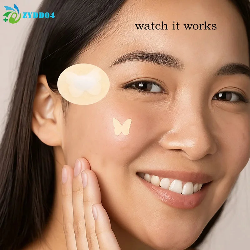 120/360Pcs Butterfly Shape Acne Pimple Patch Stickers Blemish Spot Concealer Cover 0.1Mm Acne Treatment Pimple Remover Skin Care