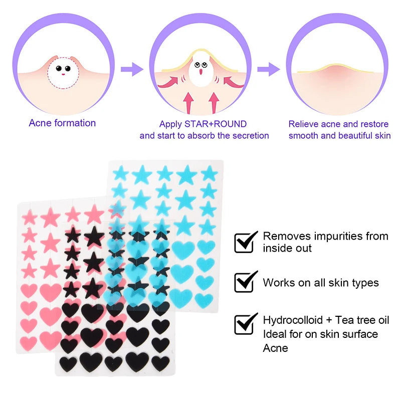 【Ad】36Pcs Hydrocolloid Colorful Pimple Patches Pimple Cover Sticker Star Shaped Invisible Pimple Cover Removal Pimple Patch