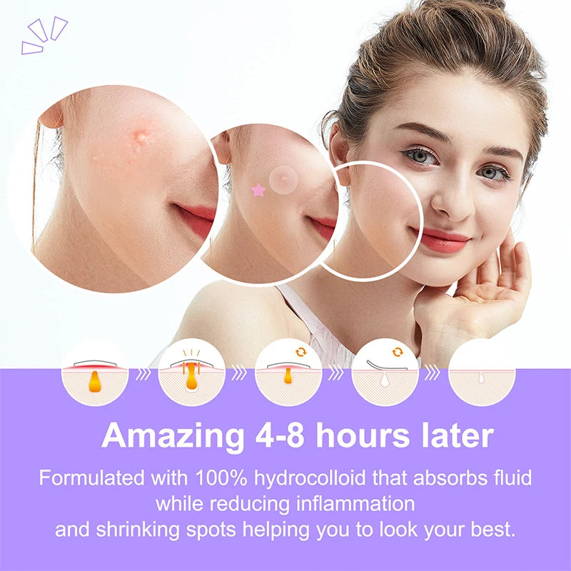 【Ad】36Pcs Hydrocolloid Colorful Pimple Patches Pimple Cover Sticker Star Shaped Invisible Pimple Cover Removal Pimple Patch