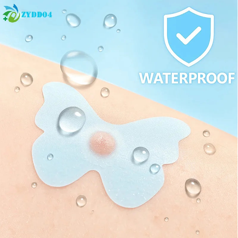 120/360Pcs Butterfly Shape Acne Pimple Patch Stickers Blemish Spot Concealer Cover 0.1Mm Acne Treatment Pimple Remover Skin Care