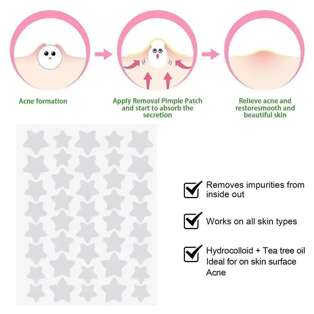 40Pcs/120Pcs Colorful PE Pimple Patches Cute Star Shaped Pimple Cover Sticker Invisible Pimple Cover Removal Pimple Patch